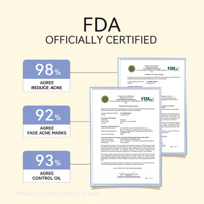 Spot Vanish Acne Drying Lotion.